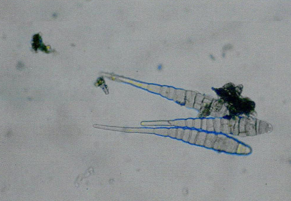 13-20 大白菜黑斑病